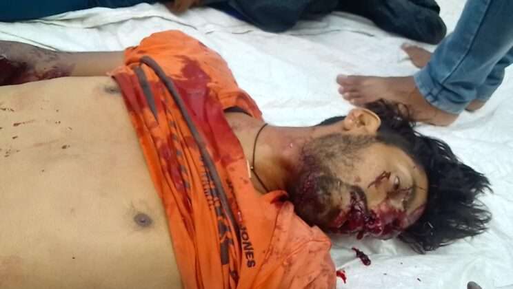 अल्मोड़ा :- पेटशाल में सड़क हादसा, पढ़ें पूरी खबर